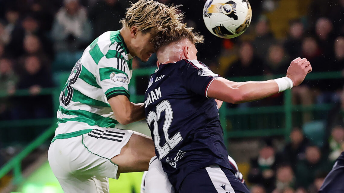 İskoçya Premier Lig’inde Son Şampiyon Celtic, Dundee FC’yi Konuk Edecek – İddaa Tahmini